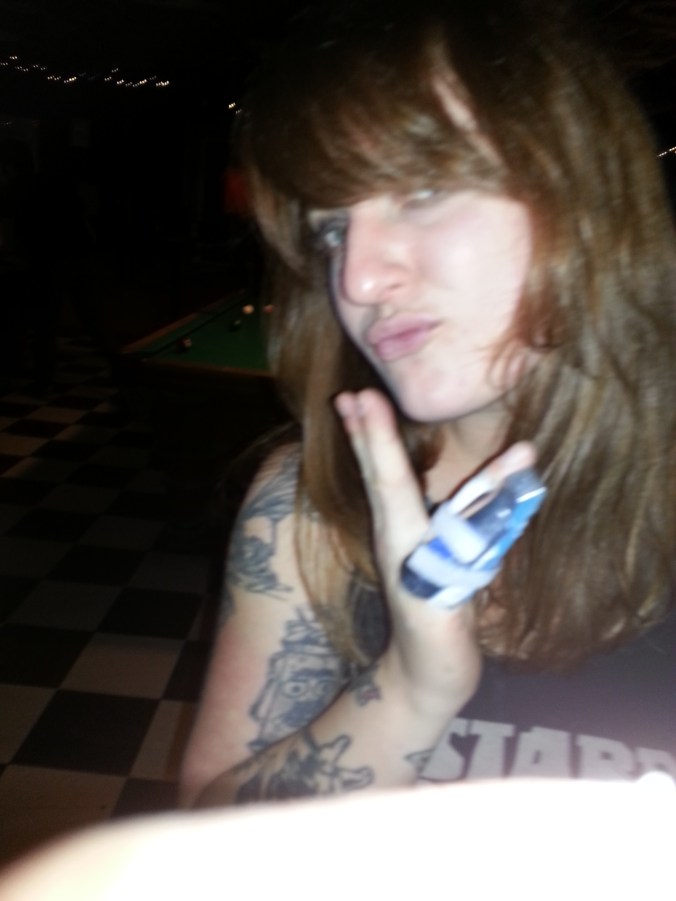 Mandey of Zog's w a broken finger